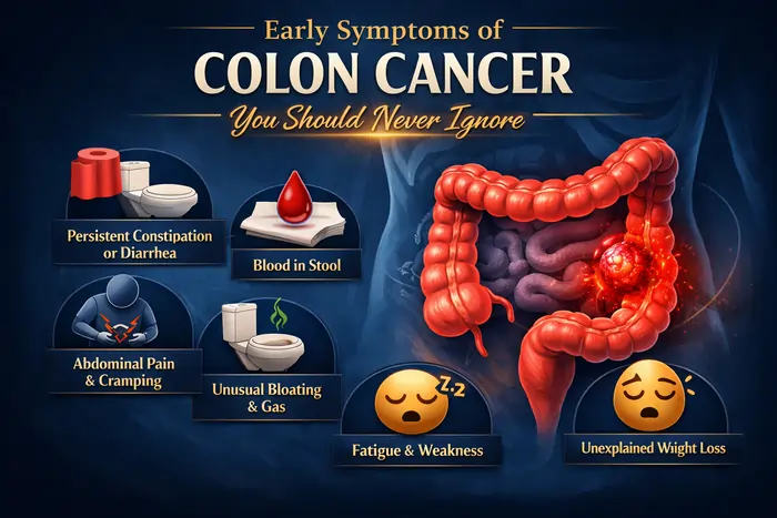 Early Symptoms of Colon Cancer 