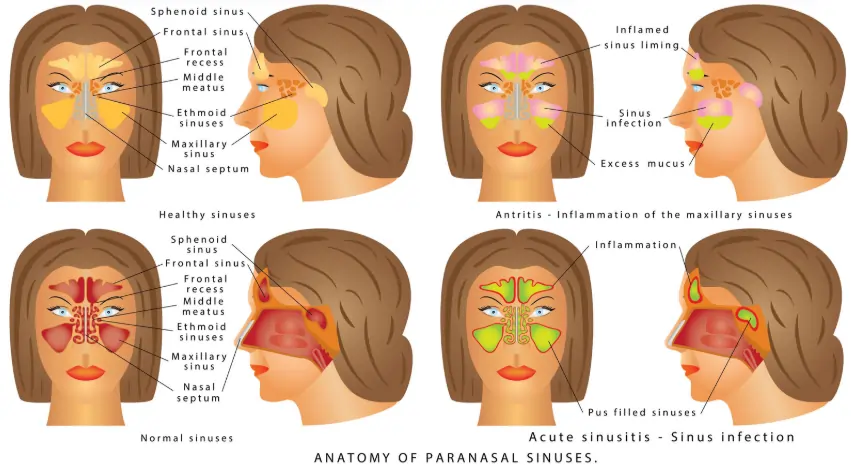 anatomy of paranasal sinuses